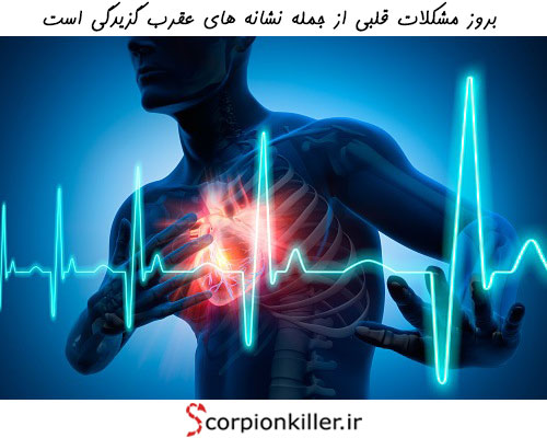 مشکلات قلبی ناشی از عقرب گزیدگی